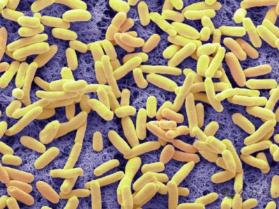 A great breakthrough in synthetic biology! A panoramic review of the birth process, design ideas, and future potential of the artificial Escherichia coli Syn61!