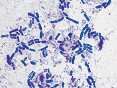 Farming doesn't require 'watching the sky to eat'! These 6 types of biological bacterial fertilizers can increase yield by 50% per mu and have a disease resistance rate of 90%, which is not a dream!