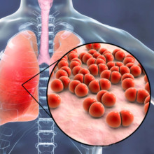 Heavy weight! The first domestic product! Zhifei Biotechnology's application for the launch of the 15 valent pneumonia vaccine has been accepted, benchmarking against Merck PCV15!