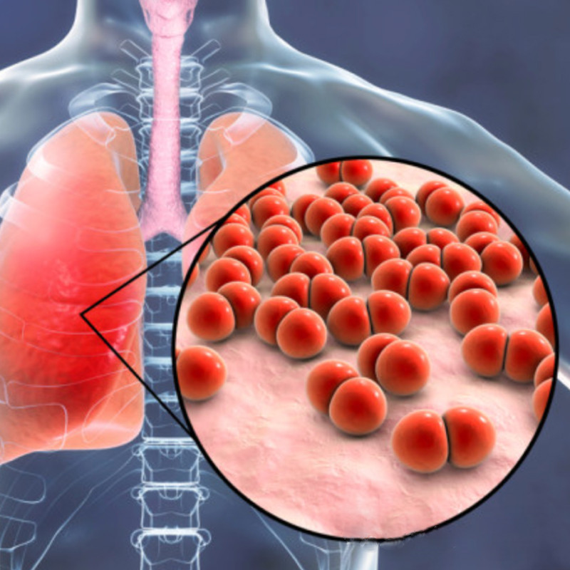 Heavy weight! The first domestic product! Zhifei Biotechnology's application for the launch of the 15 valent pneumonia vaccine has been accepted, benchmarking against Merck PCV15!