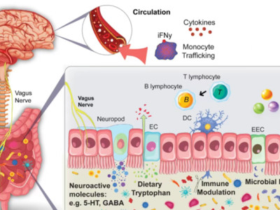 How does the gut brain axis affect emotions and blood sugar levels? How important are probiotics? The intestine has always been affecting the brain