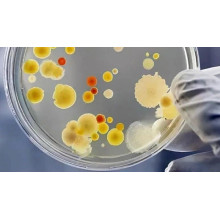 How important is high-performance bacterial strains? Whether it can make money, whether the product is stable or not, and whether it can expand its scale, mostly depends on its 