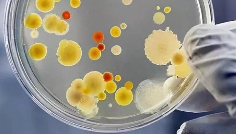 How important is high-performance bacterial strains? Whether it can make money, whether the product is stable or not, and whether it can expand its scale, mostly depends on its