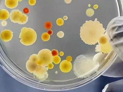 How important is high-performance bacterial strains? Whether it can make money, whether the product is stable or not, and whether it can expand its scale, mostly depends on its "ability"!