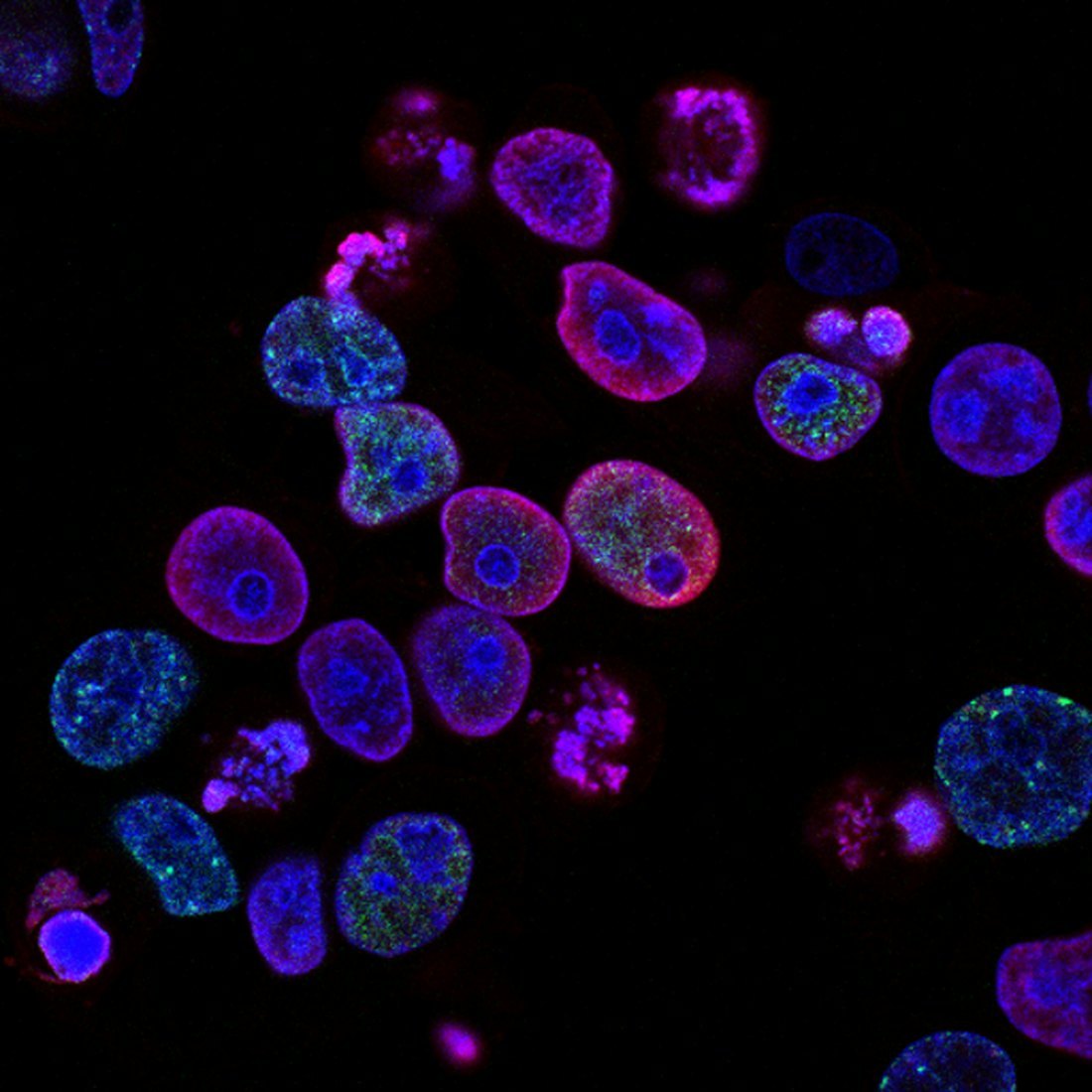 Fluorescent microscopy of cultured cells