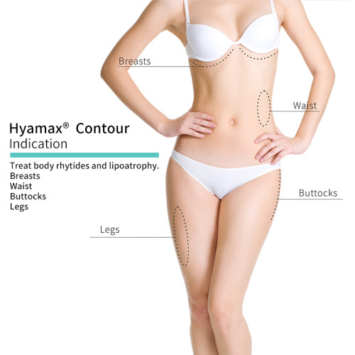 Hyamax® Contour Dermal Fillers للجسم والوجه ، مورد حشو حمض الهيالورونيك ، بيع بالجملة ومخصص