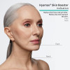 Hyamax® Skin Booster Dermal Fillers, Hyaluronic Acid Fillers Manufacturer, Support Wholesale & Custom