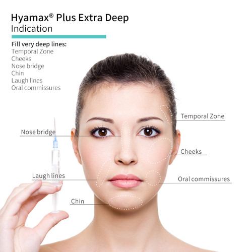 Hyamax® Plus Extra Deep Dermal Fillers مزود ، معتمد من CE ، يدعم البيع بالجملة والمخصص
