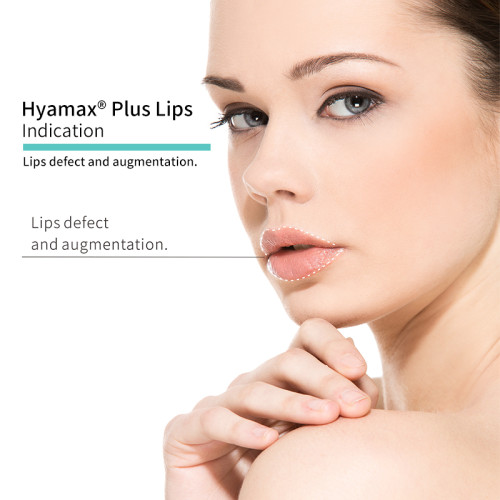 Remplisseur de Hyamax® Plus Lips, fabricant d'injections pour les lèvres certifiées CE, vente en gros et sur mesure