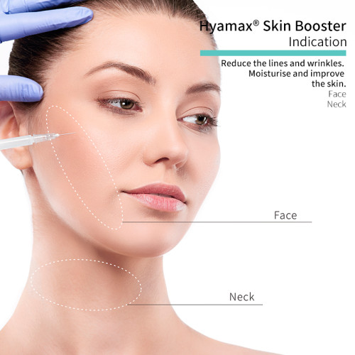 Enchimentos dérmicos Hyamax® Skin Booster, fabricante de enchimentos de ácido hialurônico, suporte por atacado e personalizado