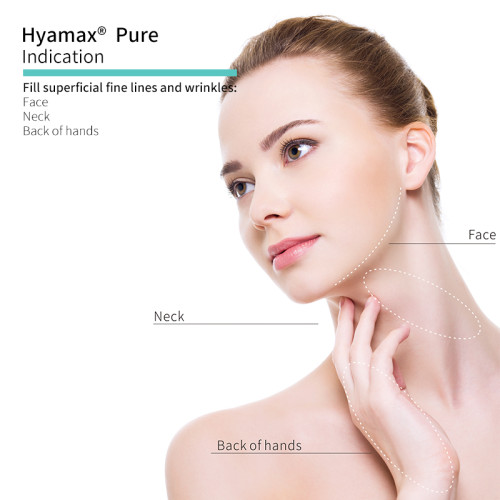 Les produits de comblement à base d'acide hyaluronique Hyamax® Pure, usine de remplissage cutané pour la vente en gros et sur mesure