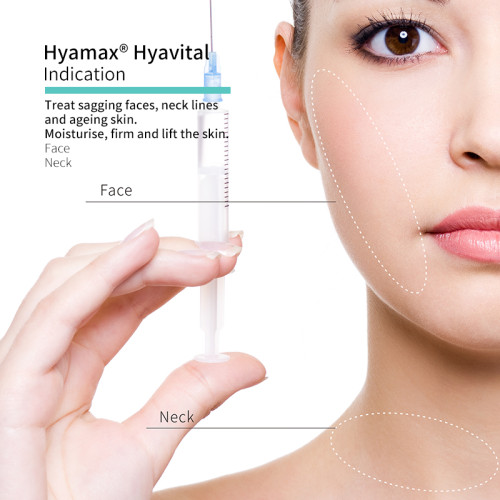 Hyamax® Hyavital Hyaluronic Acid Face Fillers, Marcas de Preenchimentos Dérmicos, Suporte Atacado e Personalizado