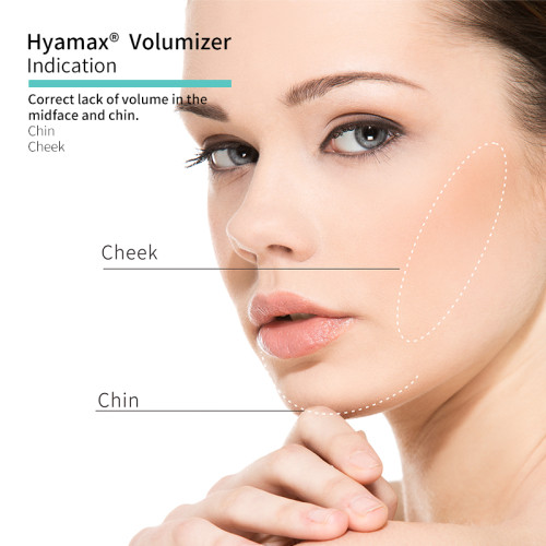Hyamax® Volumizer Dermal Fillers ، Chin Filler ، مورد حشو حمض الهيالورونيك ، بيع بالجملة ومخصص