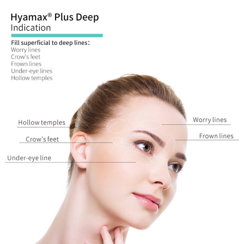 Hyamax® Plus Deep Face Fillers, proveedor de rellenos dérmicos con certificación CE, soporte al por mayor y personalizado