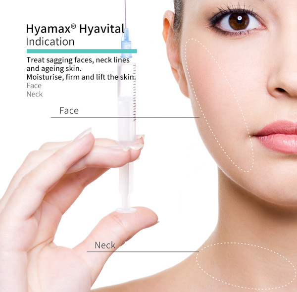 Os preenchimentos dérmicos ficam melhores com o tempo? Revele a verdade