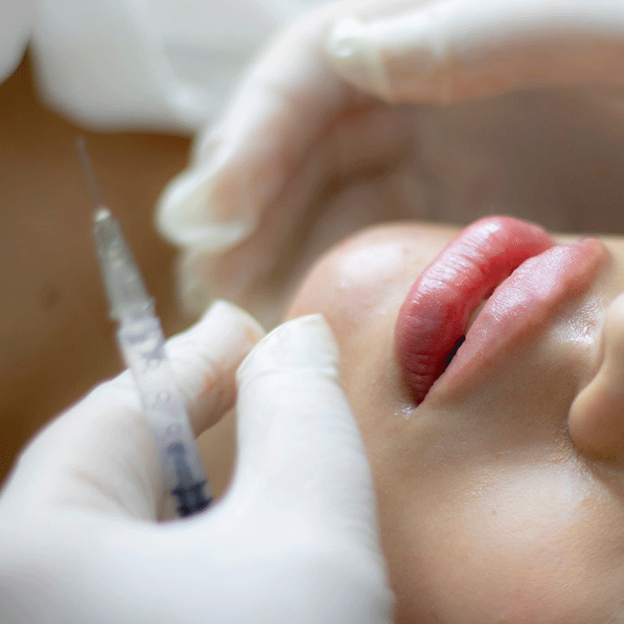¿Cómo tener labios de arco de cupido?