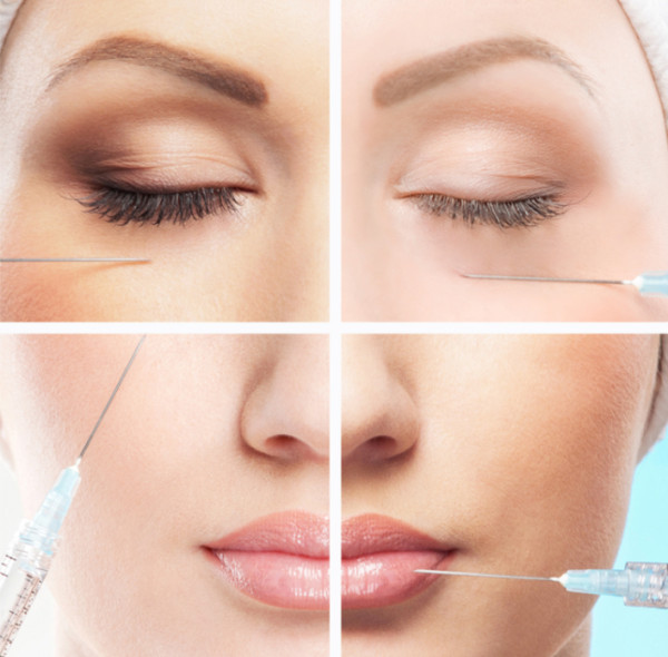 Quais são os diferentes tipos de preenchimentos dérmicos?