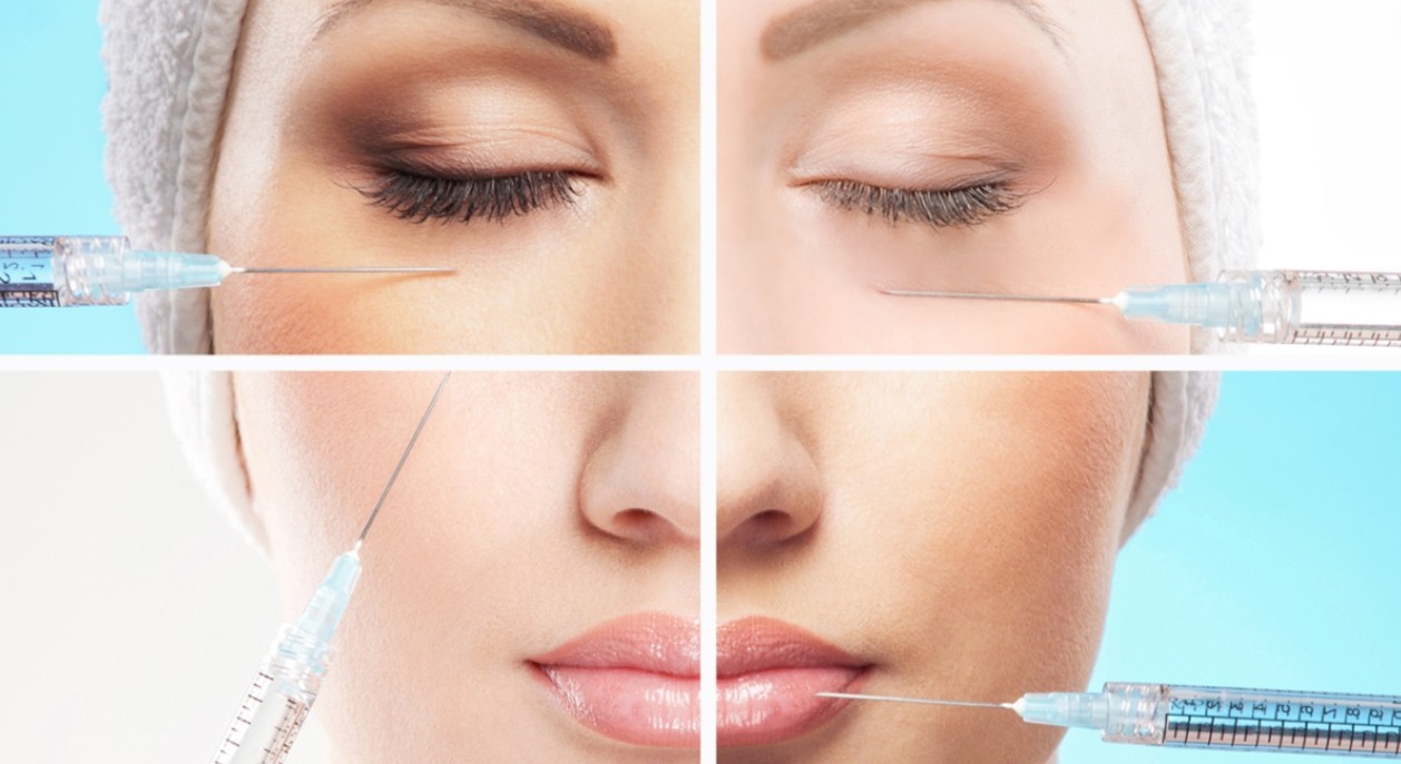 dermal fillers 