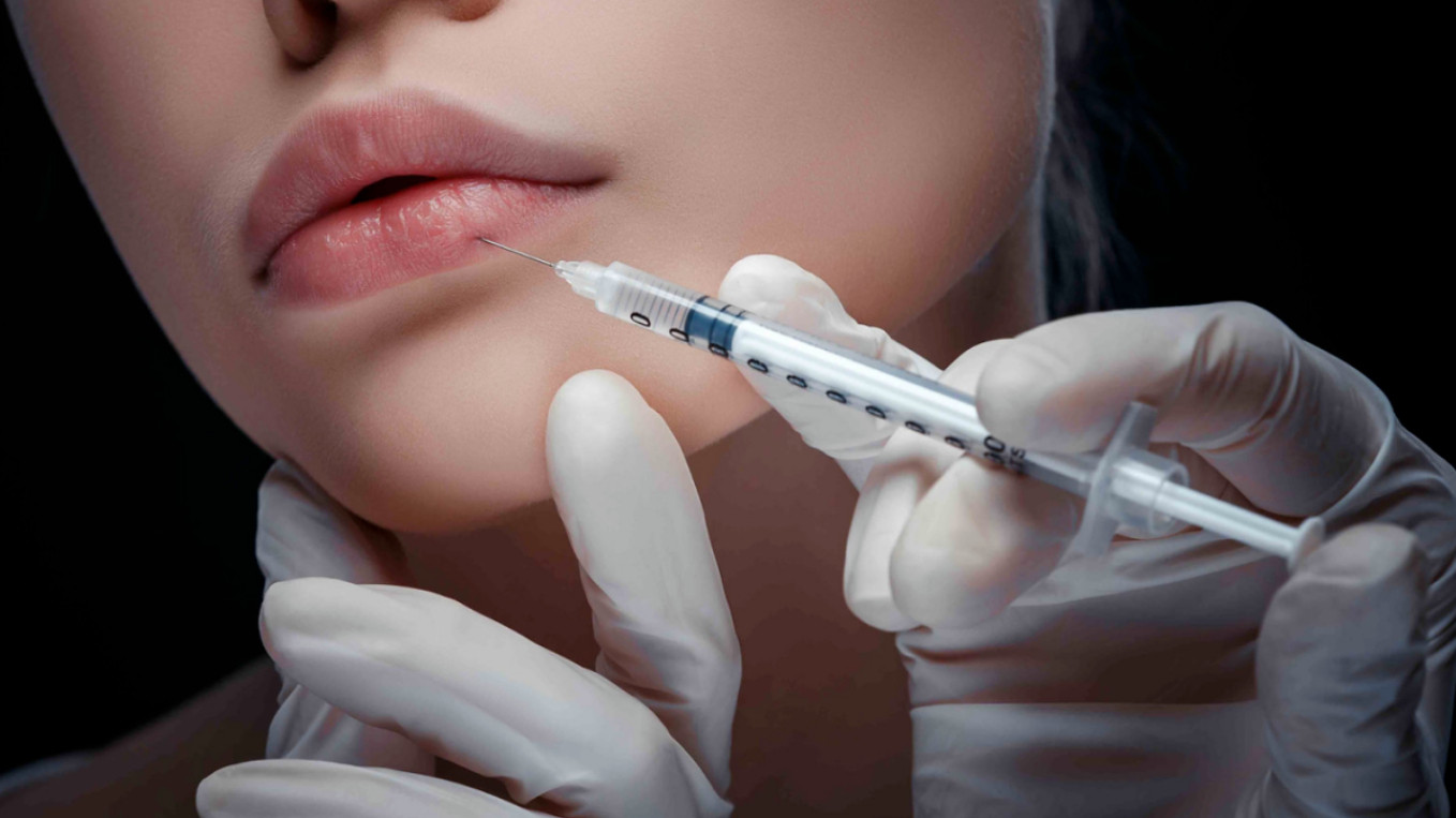 Dermal Fillers