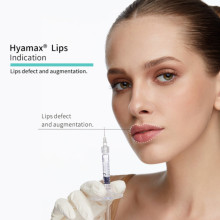 Dermal Fillers Cost: Types, Duration, and More