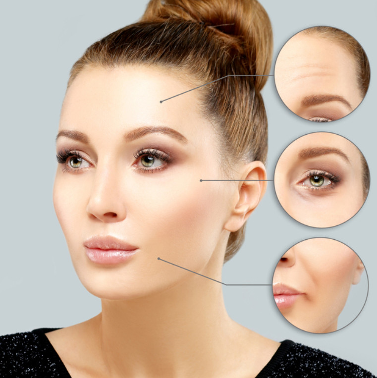 Qual é a diferença entre botox e preenchimento dérmico?