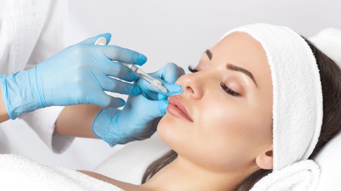 hyaluronic acid fillers for lip