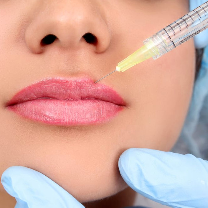 Reasons to Choose HA Dermal Fillers Over Collagen for Lip Injections