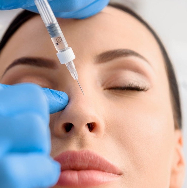 Nose Dermal Fillers Guide