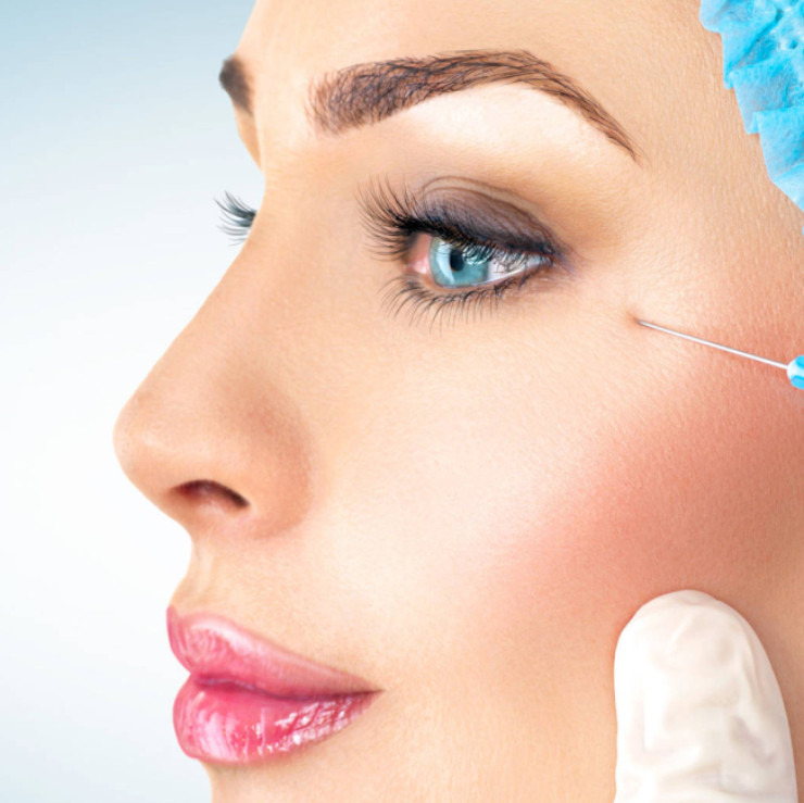 Tratamientos de relleno para la cara, los labios y el área debajo de los ojos: 10 cosas que debe saber
