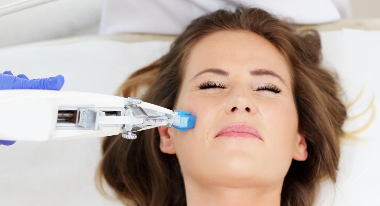Face Mesotherapy 