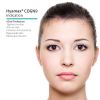 Hyamax® Mesoterapia COGN 9, Fabricación de estética médica Skin Perfect, soporte al por mayor y personalizado
