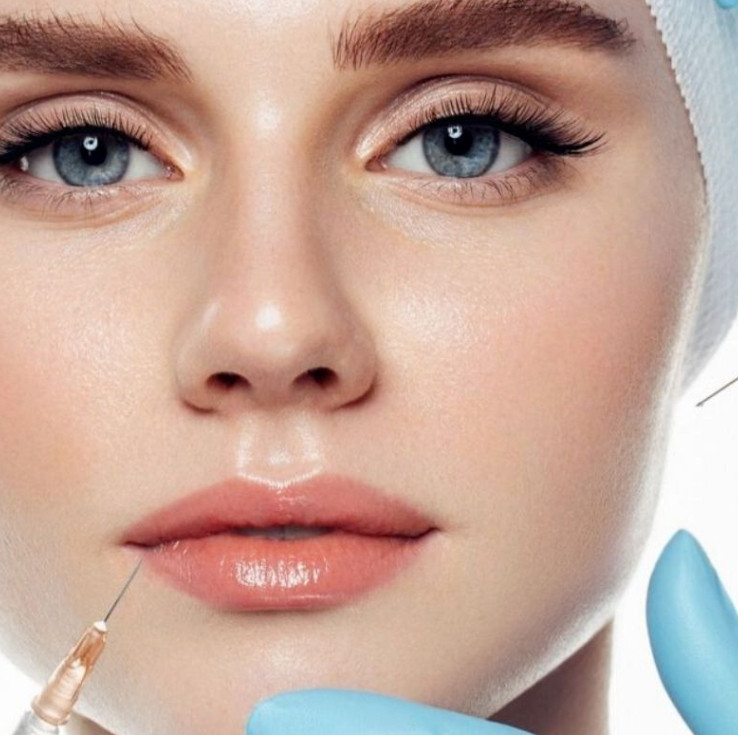 Dermal Fillers: Dos and Don'ts for Lip Wrinkles