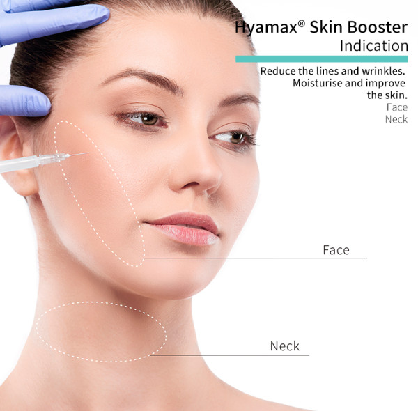 Contour Magic: dê forma ao seu rosto com preenchimentos dérmicos