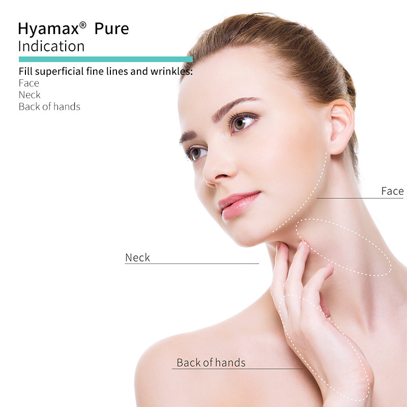 Dermal Fillers