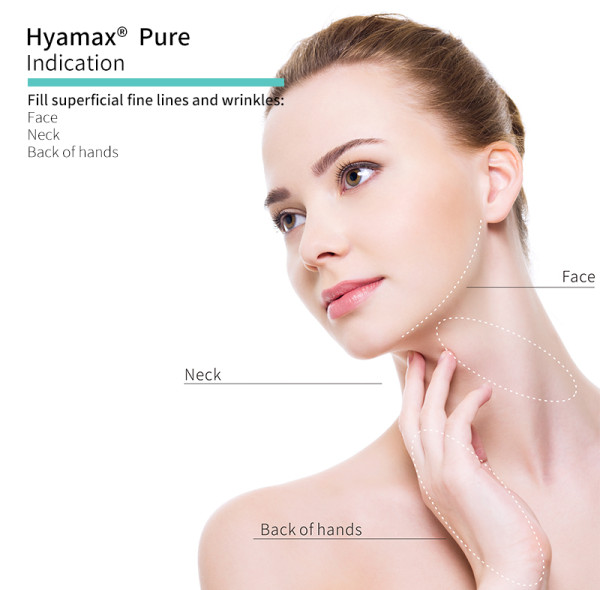 Ácido hialurônico não reticulado vs. preenchimentos tradicionais: o que é melhor?