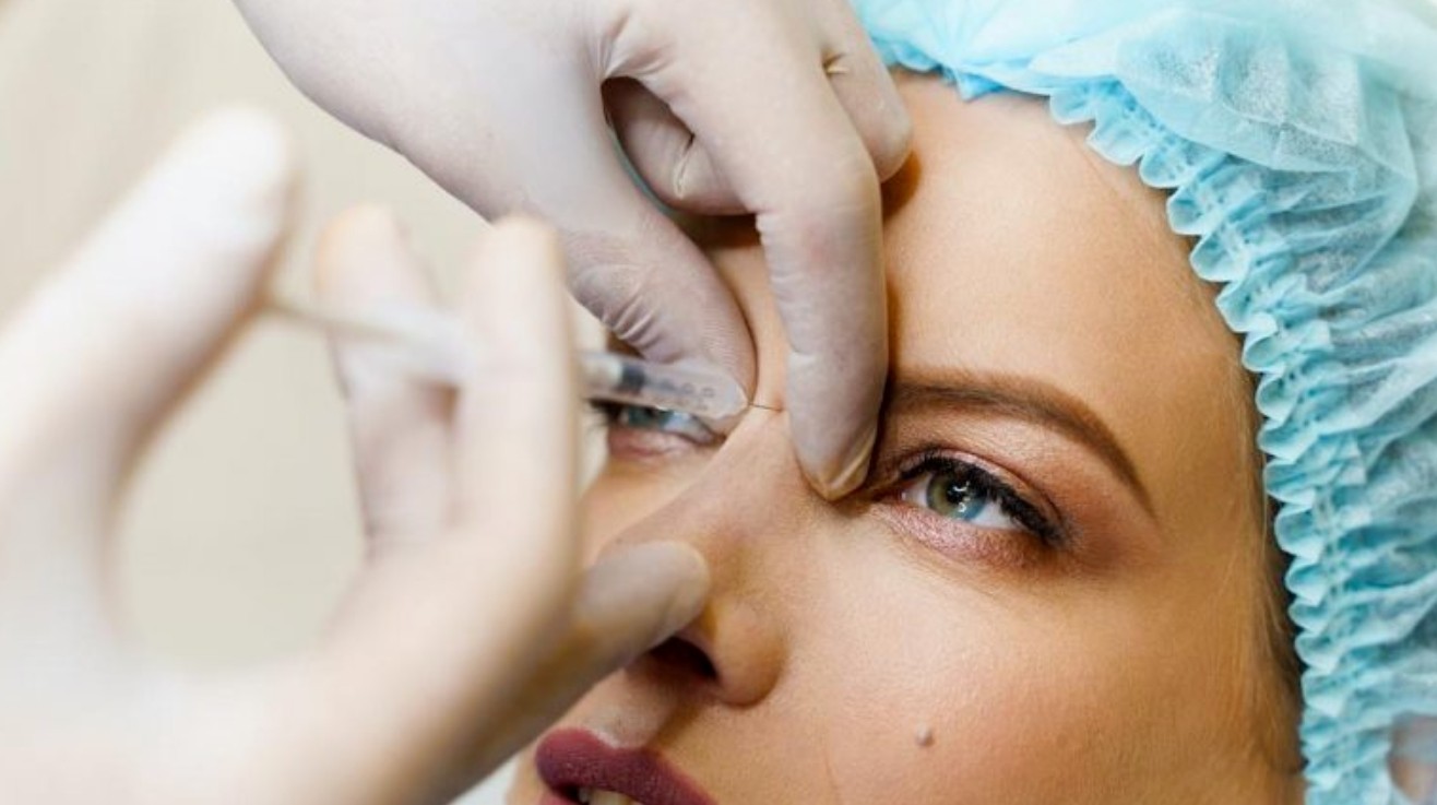 Hyaluronic Acid Dermal Fillers