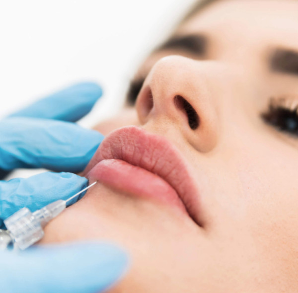 Preenchimentos labiais 101: um guia abrangente para as últimas tendências