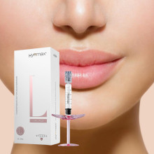 5 Benefits and Expected Results of Dermal Fillers for Lips
