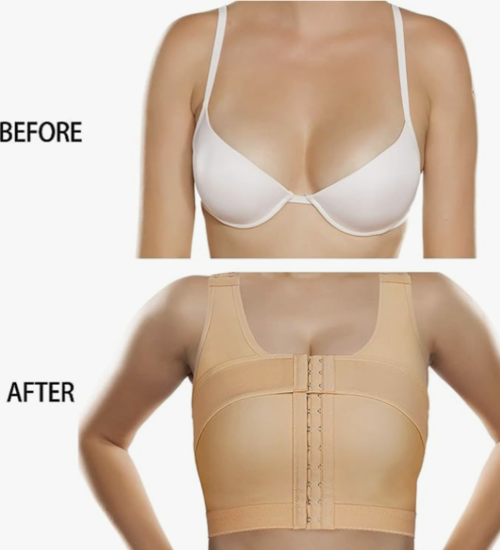 Personnaliser le soutien-gorge ouvert sur le devant après une mastectomie