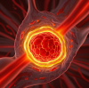 What is Hyperbaric Oxygen Therapy?