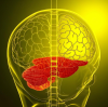 Traumatic and Hypoxic Brain Injury and Hyperbaric Oxygen Therapy