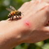 Venomous Bites or Stings: How Hyperbaric Oxygen Therapy Helps