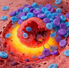 Inflammation and Hyperbaric Oxygen Therapy
