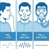 Stop Fixating Only on Oxygen Concentration and Flow Rate! The Real Core Indicator of Oxygen Therapy That Most People Get Wrong