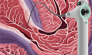 What Should Be Avoided When Using Portable Veterinary Endoscopes?
