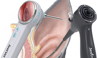 Smart Veterinary Otoscope vs. Veterinary Flexible Otoscope: Similarities and Differences