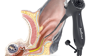 The Versatile Veterinary Tool: Portable Animal Endoscope