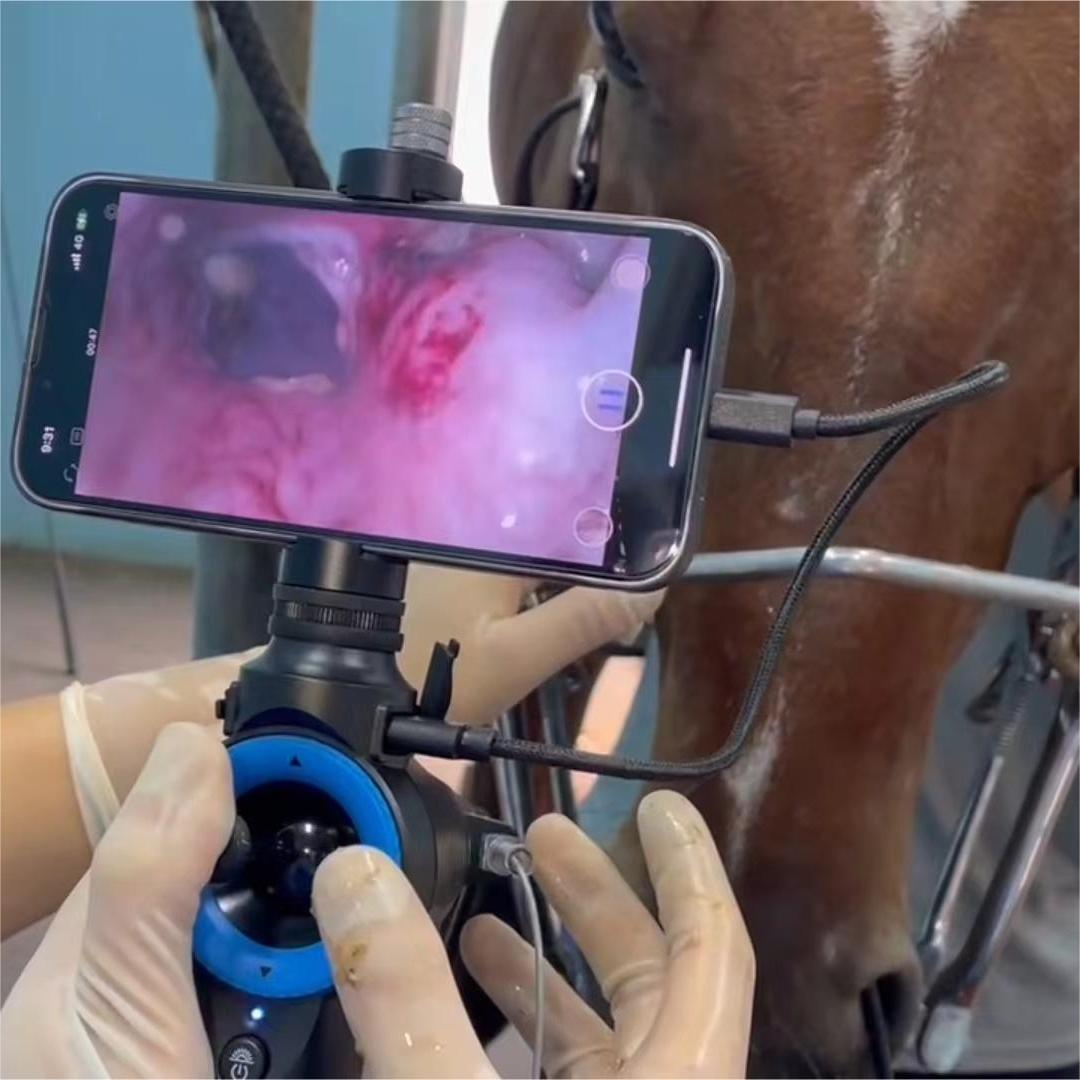 Gastroscope Application-3