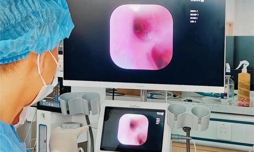 Veterinary Endoscopy Workstation: Combining Endoscope and Aspiration Suction Technology