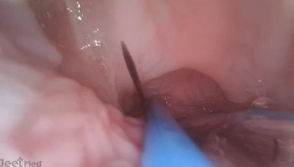 Veterinary Endoscope Case